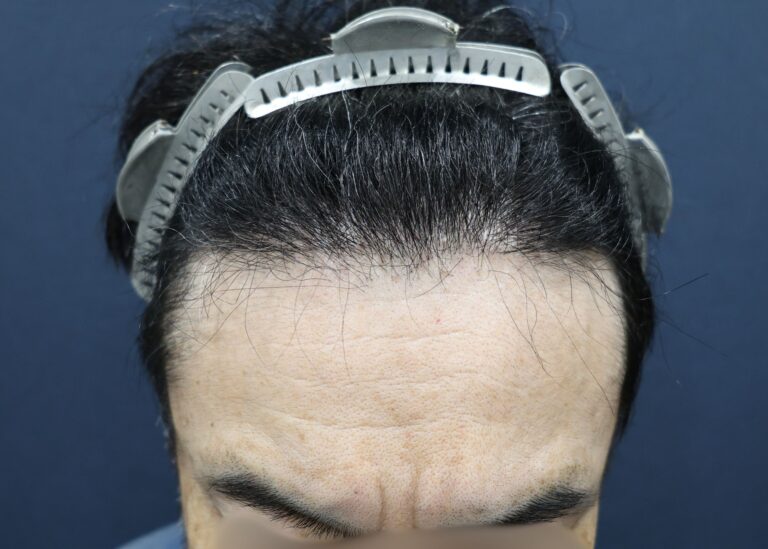 症例写真