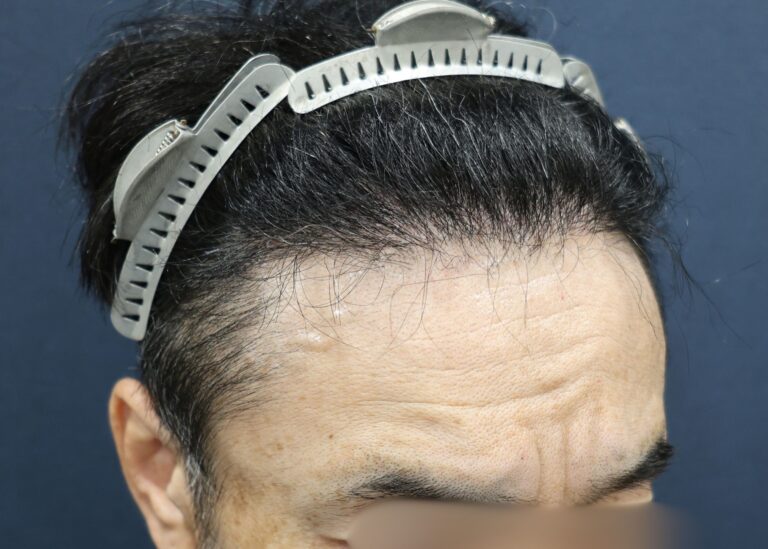 症例写真