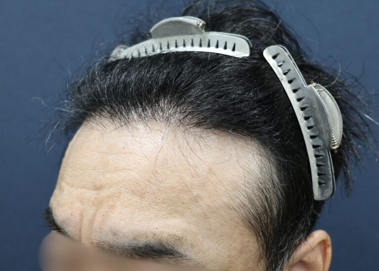 症例写真