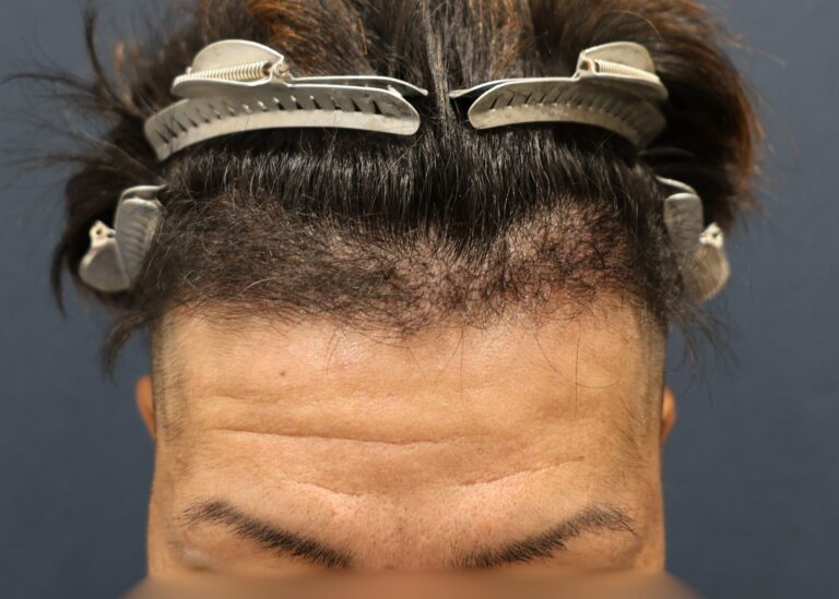 症例写真