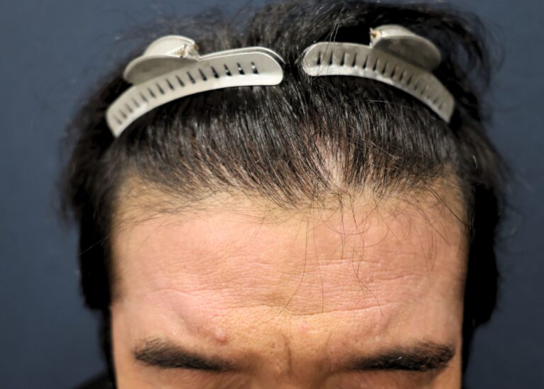 症例写真
