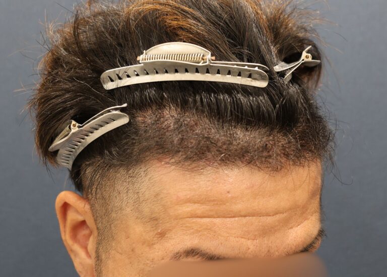 症例写真
