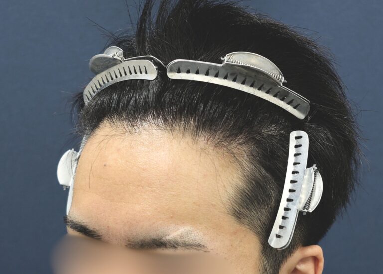 症例写真
