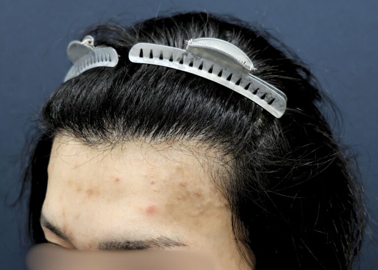 症例写真