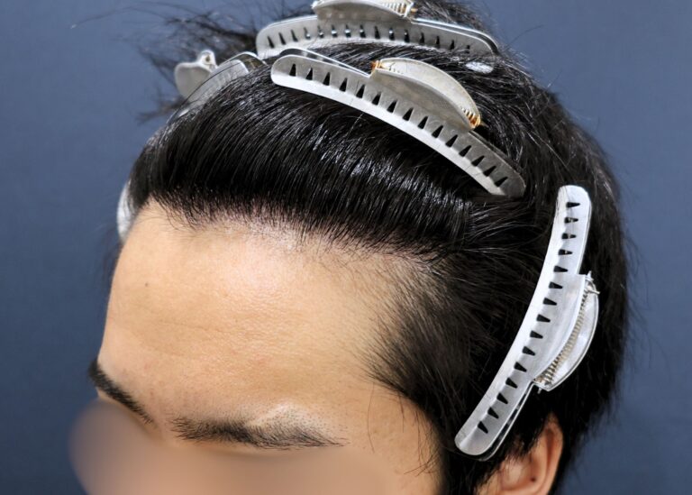症例写真