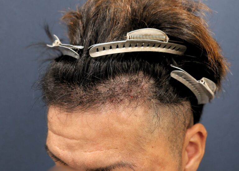 症例写真
