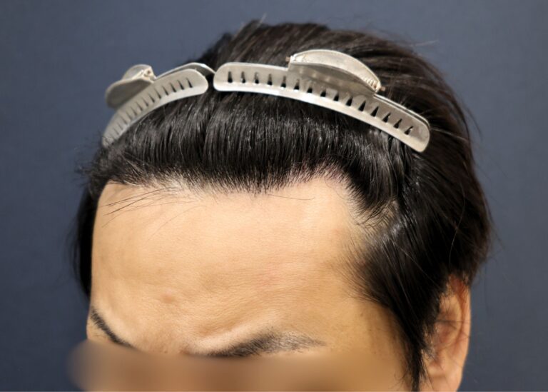 症例写真