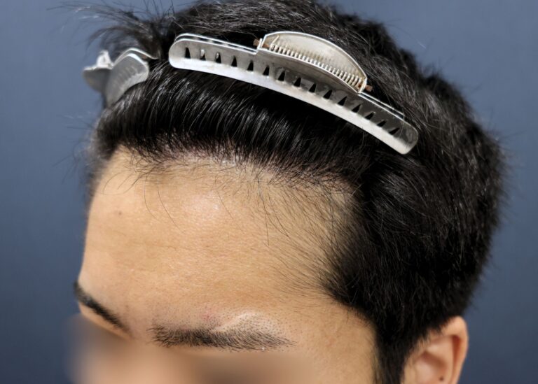 症例写真