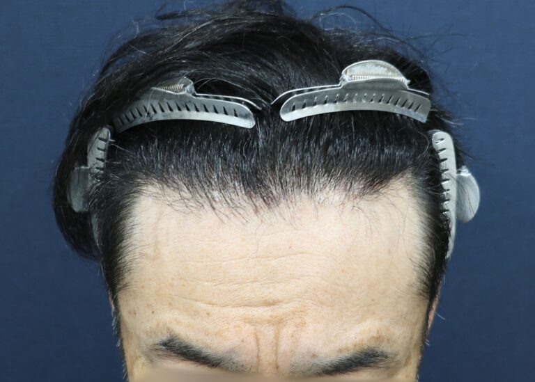 症例写真