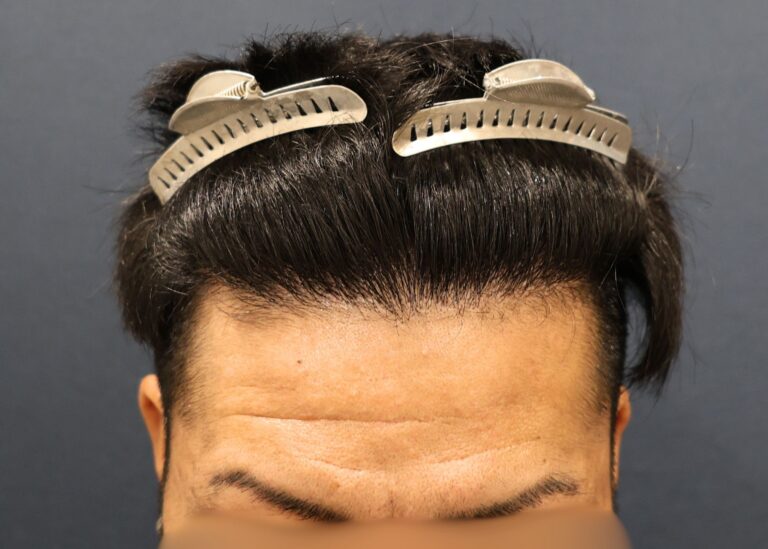 症例写真