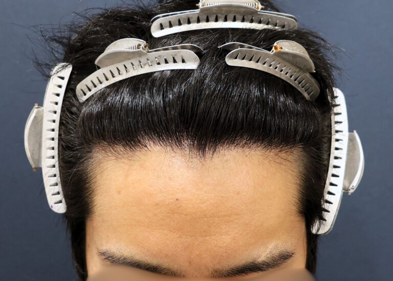 症例写真