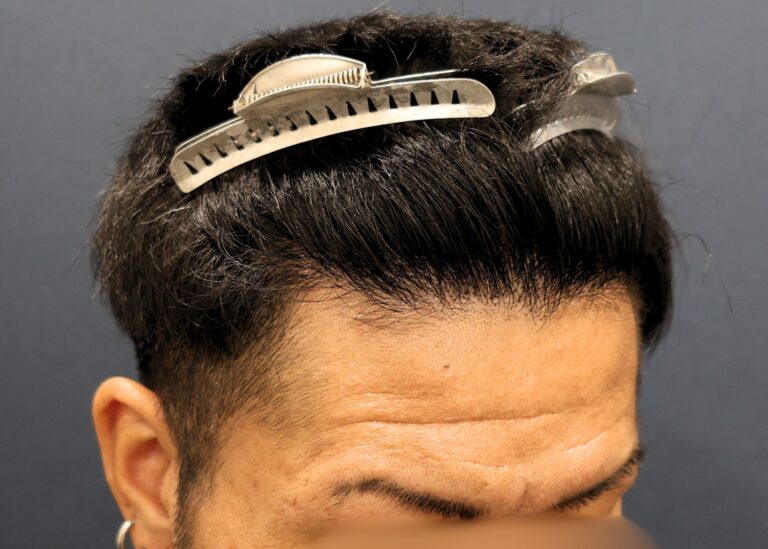 症例写真