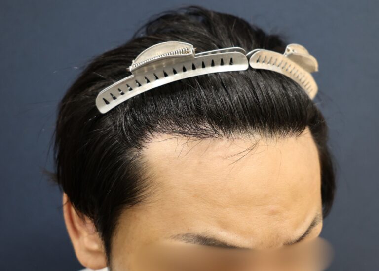 症例写真
