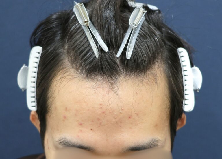 症例写真