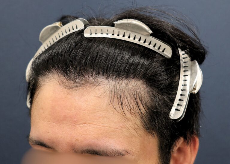 症例写真