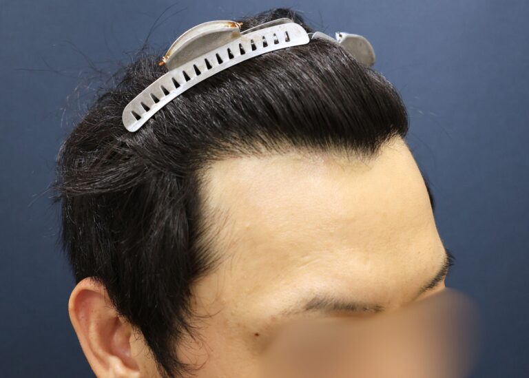 症例写真