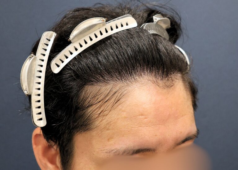 症例写真