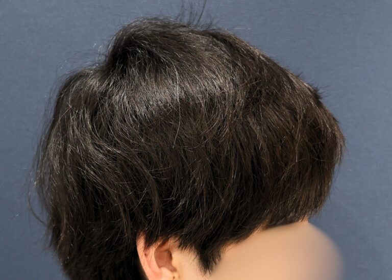 症例写真