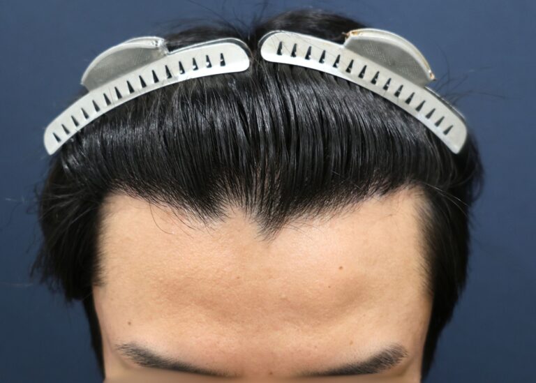 症例写真