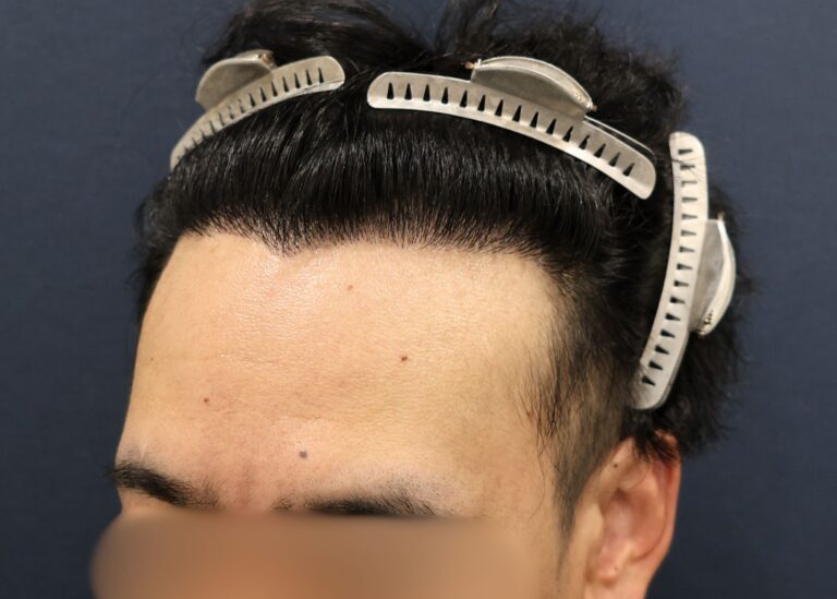 症例写真