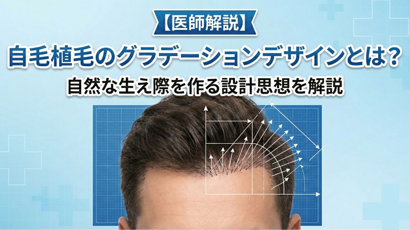 【医師解説】自毛植毛のグラデーションデザインとは？自然な生え際を作る設計思想を解説