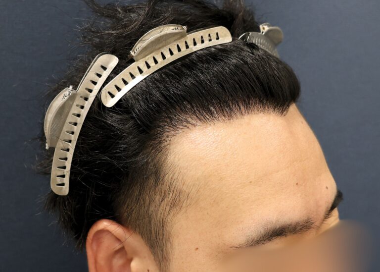 症例写真
