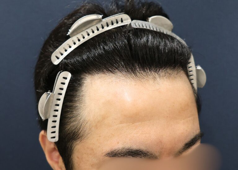 症例写真