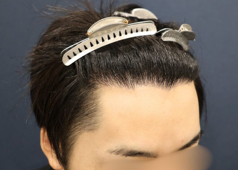 症例写真