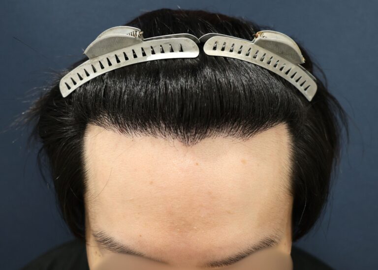 症例写真