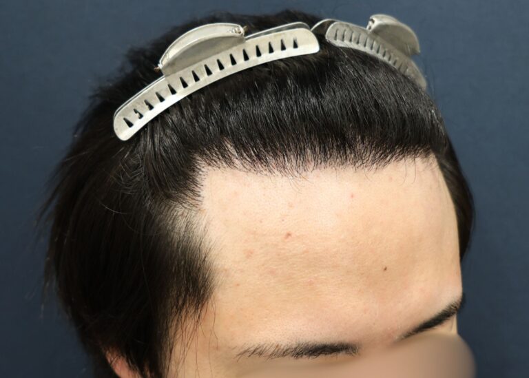 症例写真