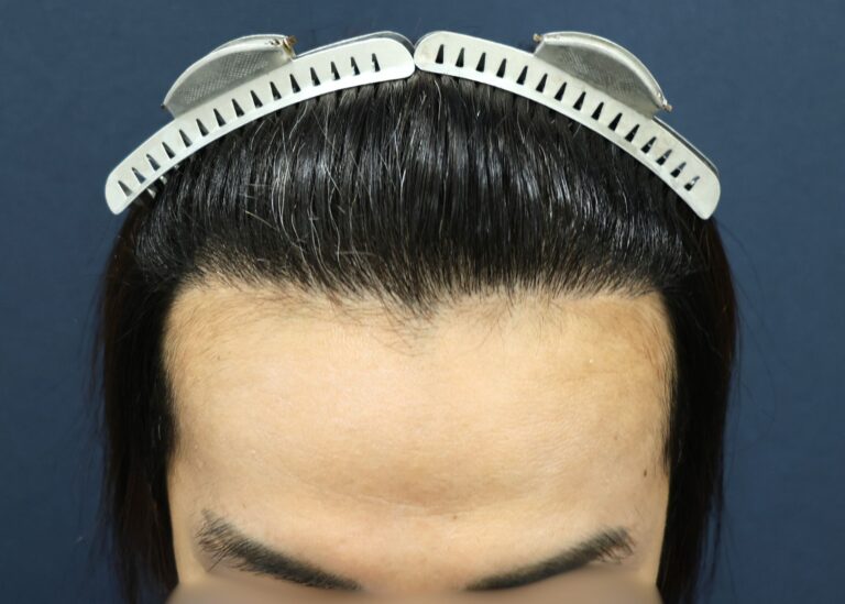 症例写真