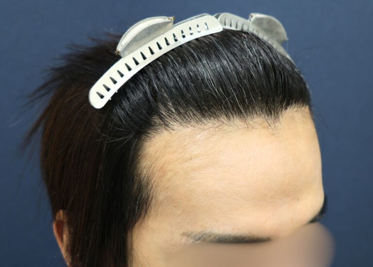 症例写真