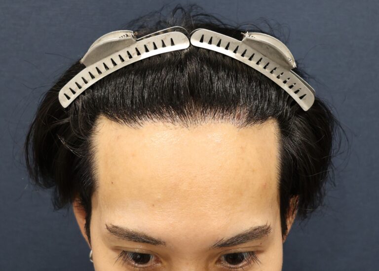 症例写真