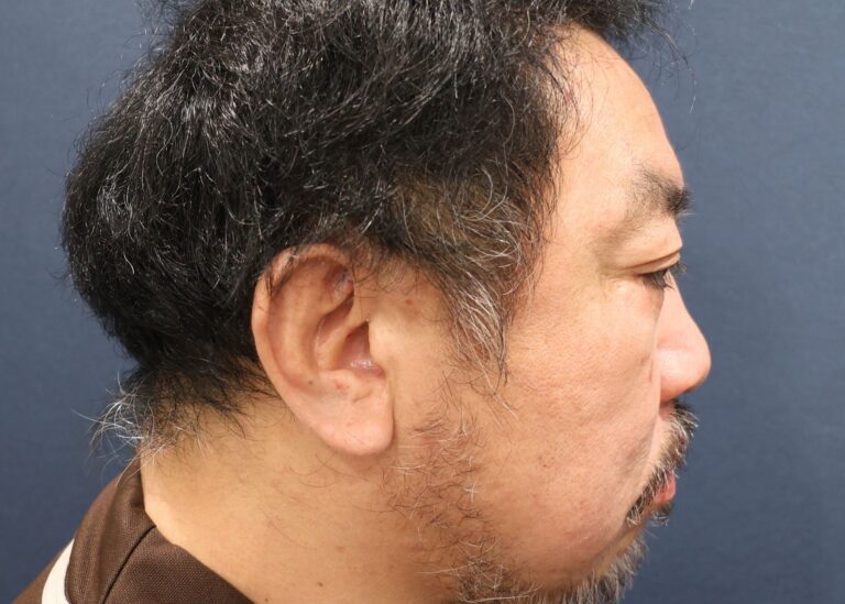 症例写真