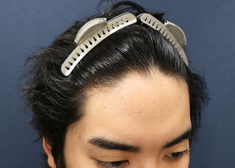 症例写真
