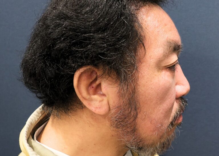 症例写真