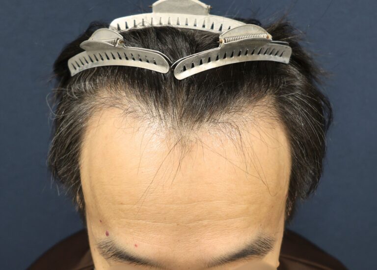 症例写真