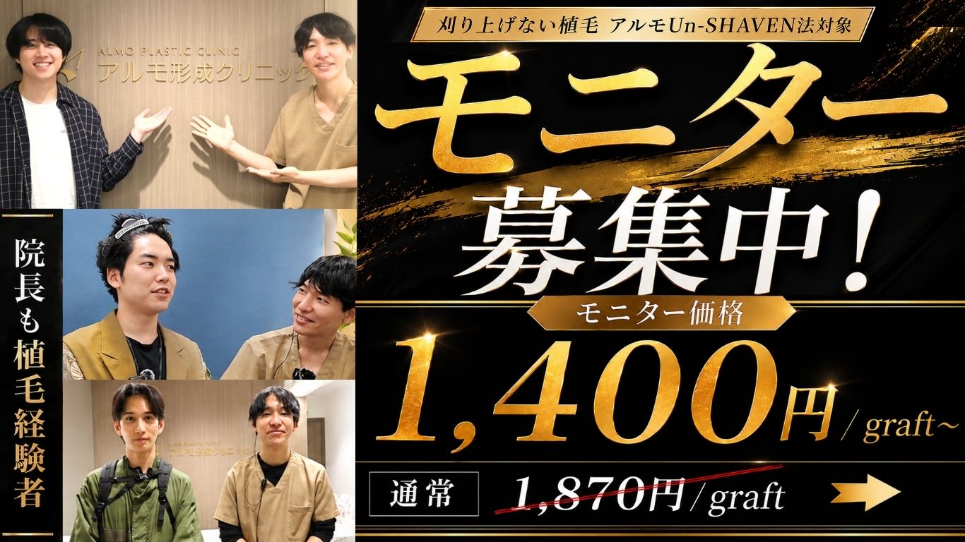 自毛植毛｜全顔動画モニター募集のお知らせ