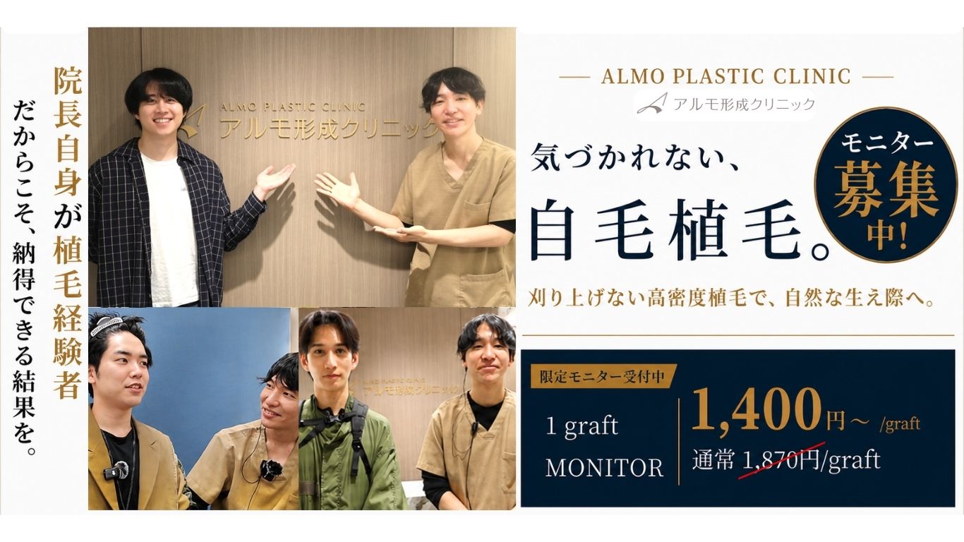 自毛植毛｜顔出し動画モニター募集のお知らせ｜東京の植毛クリニック
