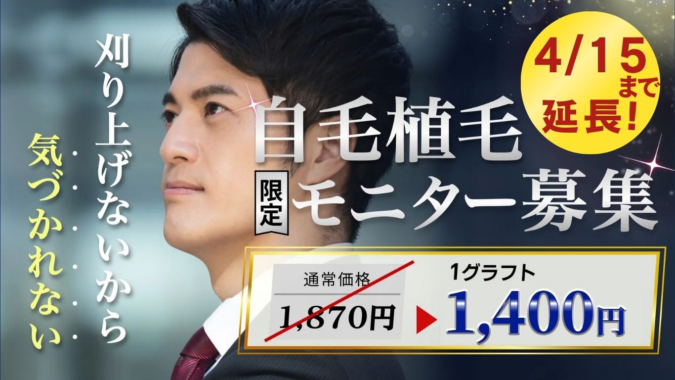 【ご好評につき期間延長】自毛植毛｜顔出し動画モニター募集のお知らせ