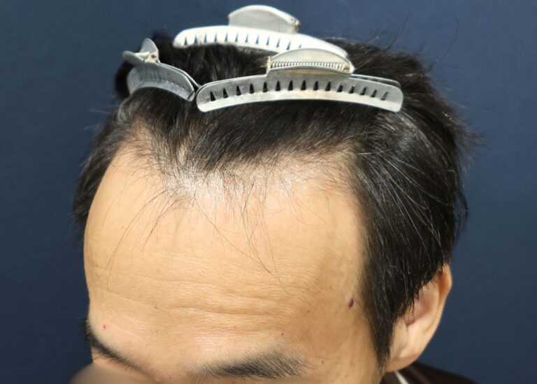 症例写真
