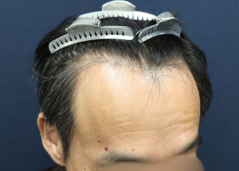 症例写真