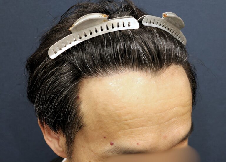 症例写真