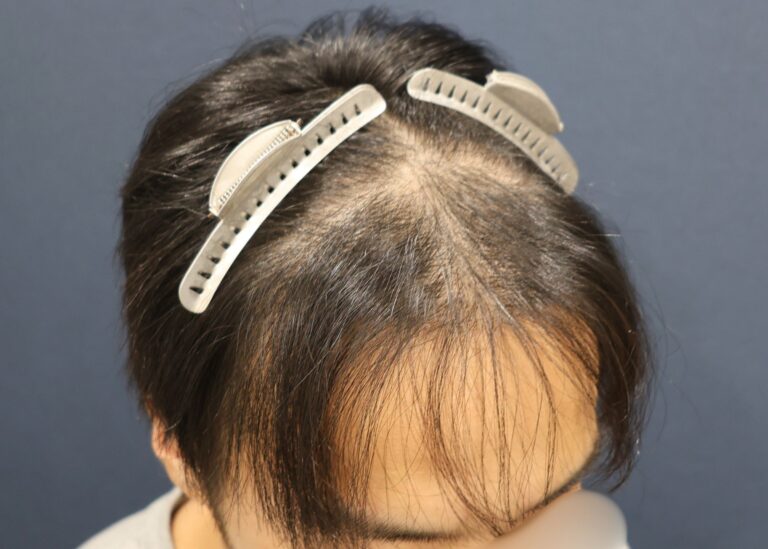 症例写真