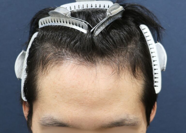 症例写真