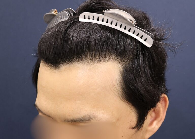 症例写真