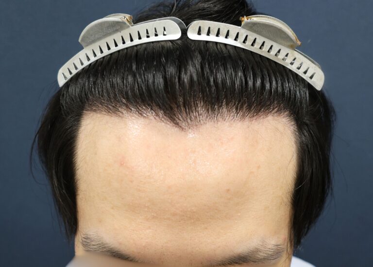 症例写真