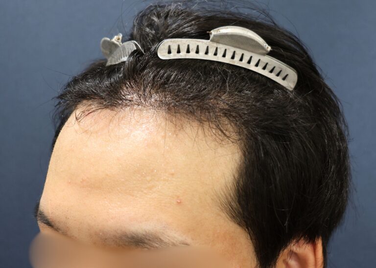 症例写真