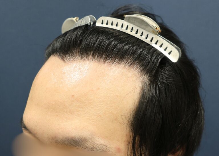 症例写真