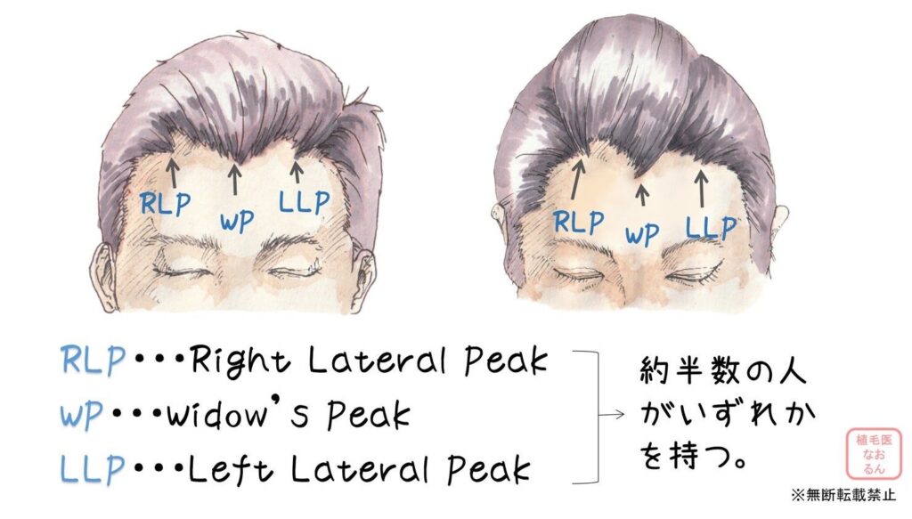 東京の高密度植毛のヘアデザインの極意